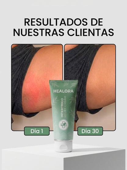 Crema Healora® Anti-Roce